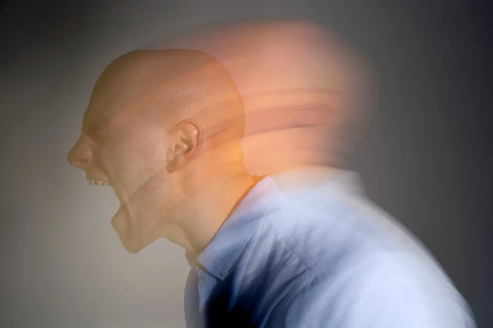 Advanced Epilepsy Treatment in Kanpur